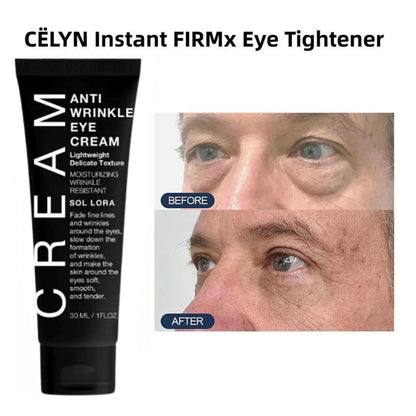 RevitaEyes™ - Ögonuppstramande kräm